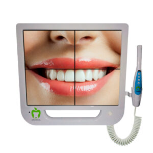 CAMARA INTRAORAL 2.0